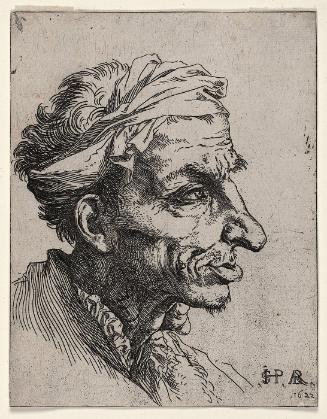 Head of a Man with Goiter