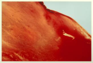 Blood and Semen V (from "In a Dream...")