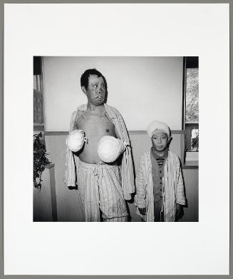 Burn Patients, Beijing (from "The Chinese")